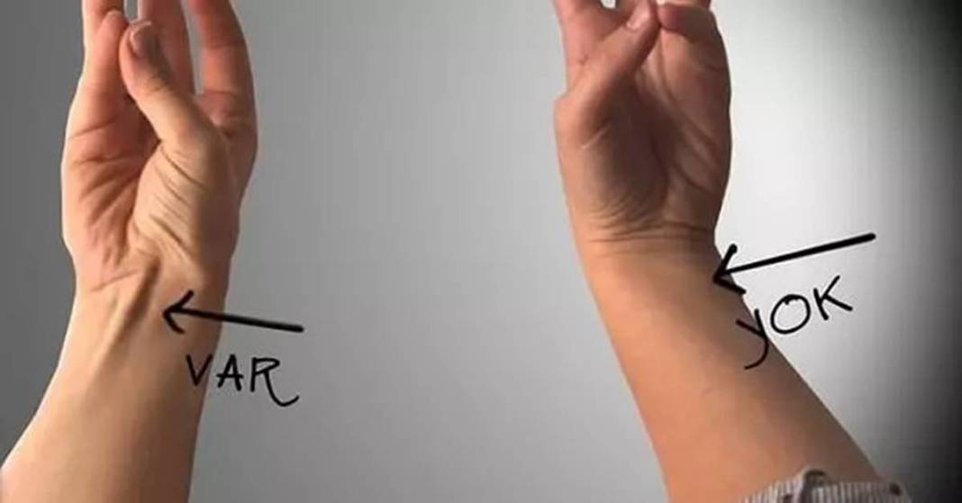 Bu fiziksel özelliklere sahipseniz şanslı azınlıktasınız! Doğuştan geliyor ve nadir bulunuyor 8